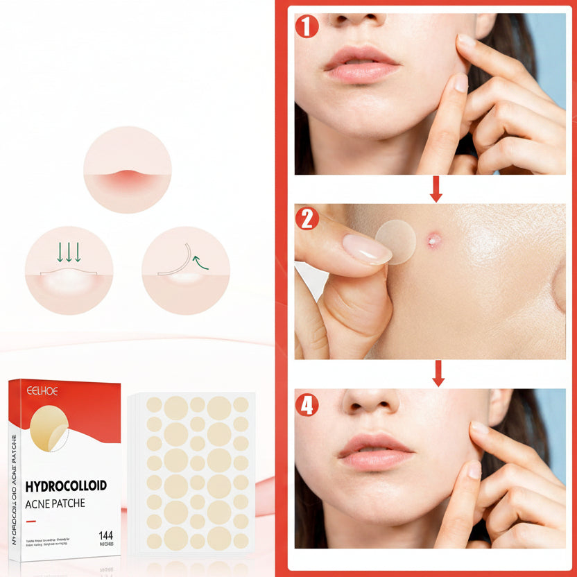 Hydrocolloid acne patch product with usage instructions and before/after effects on skin.