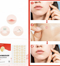 Hydrocolloid acne patch product with usage instructions and before/after effects on skin.